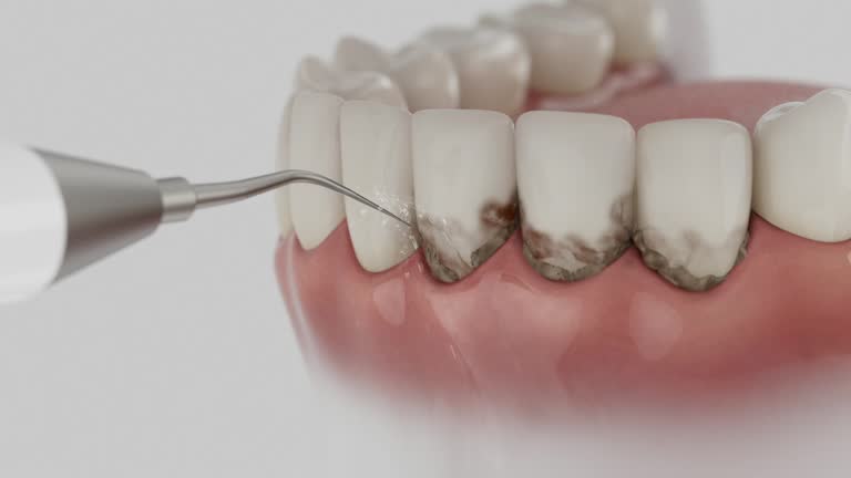 Reliable Teeth Cleaning And Checkup contractor in Jackson County County, SD by Dentist Open Now
